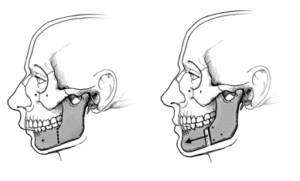 Lower Jaw Diagram