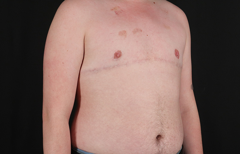 After - right_oblique