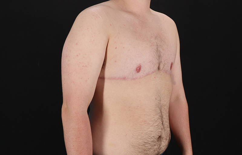 After - right_oblique