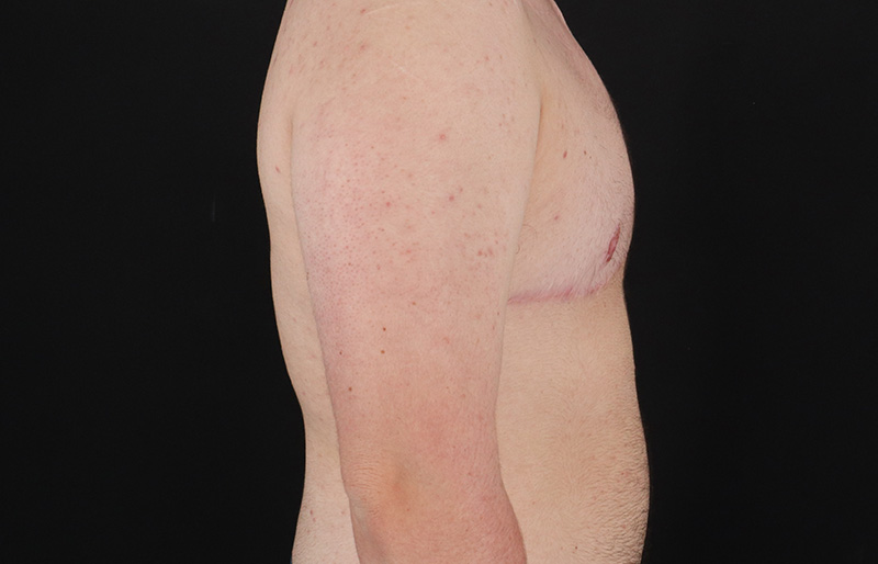 After - right_lateral