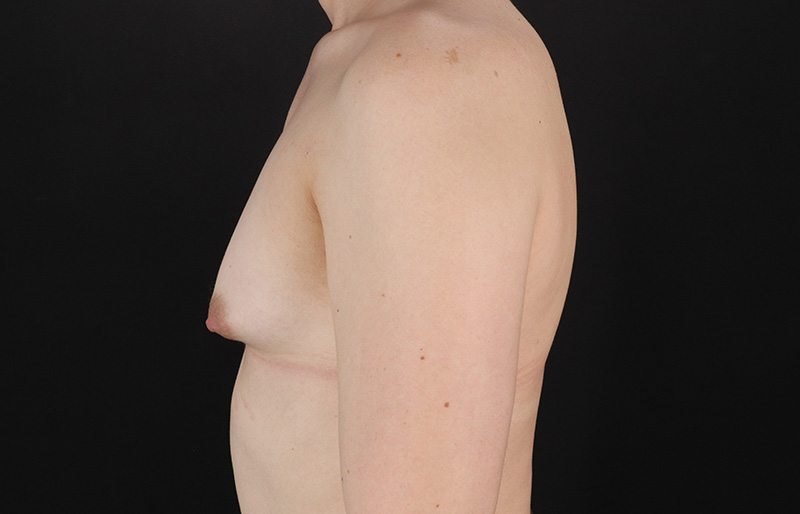 Before - left_lateral