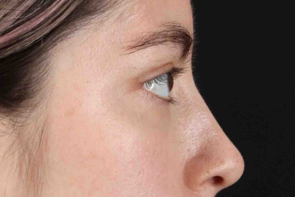 After - right_lateral