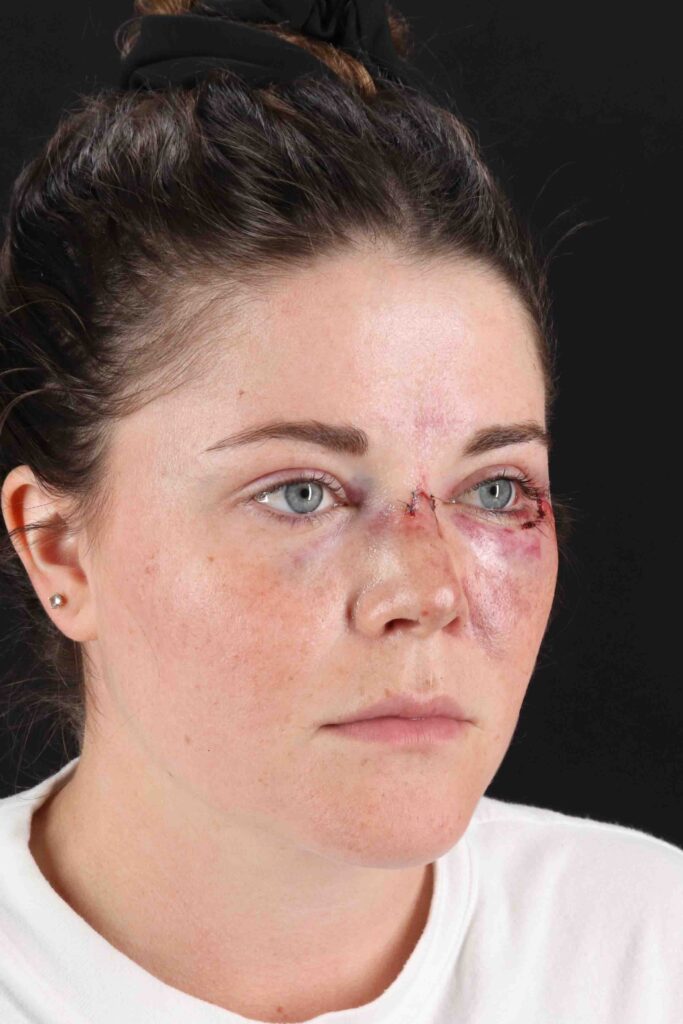 Before - right_oblique