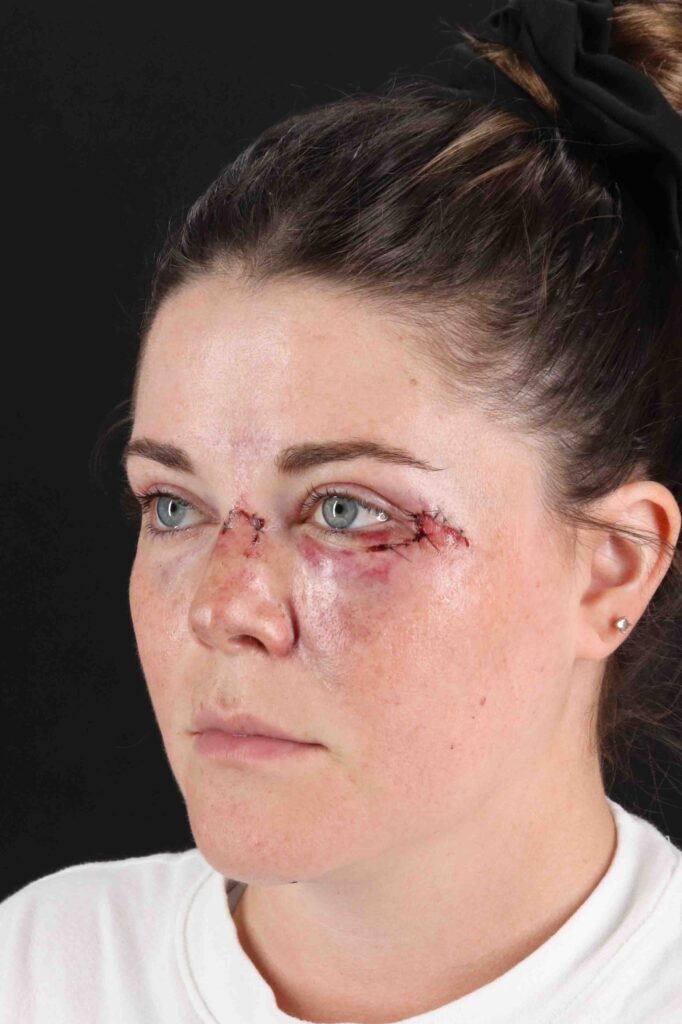 Before - left_oblique