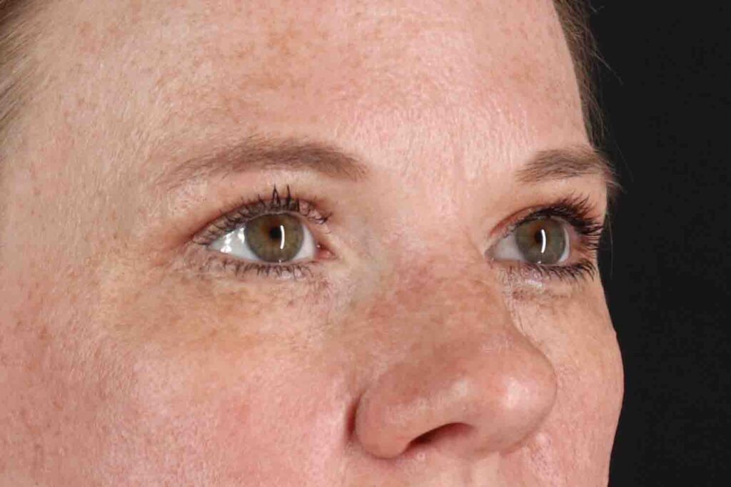 After - right_oblique