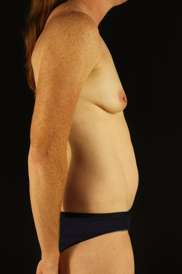 Before - right_lateral