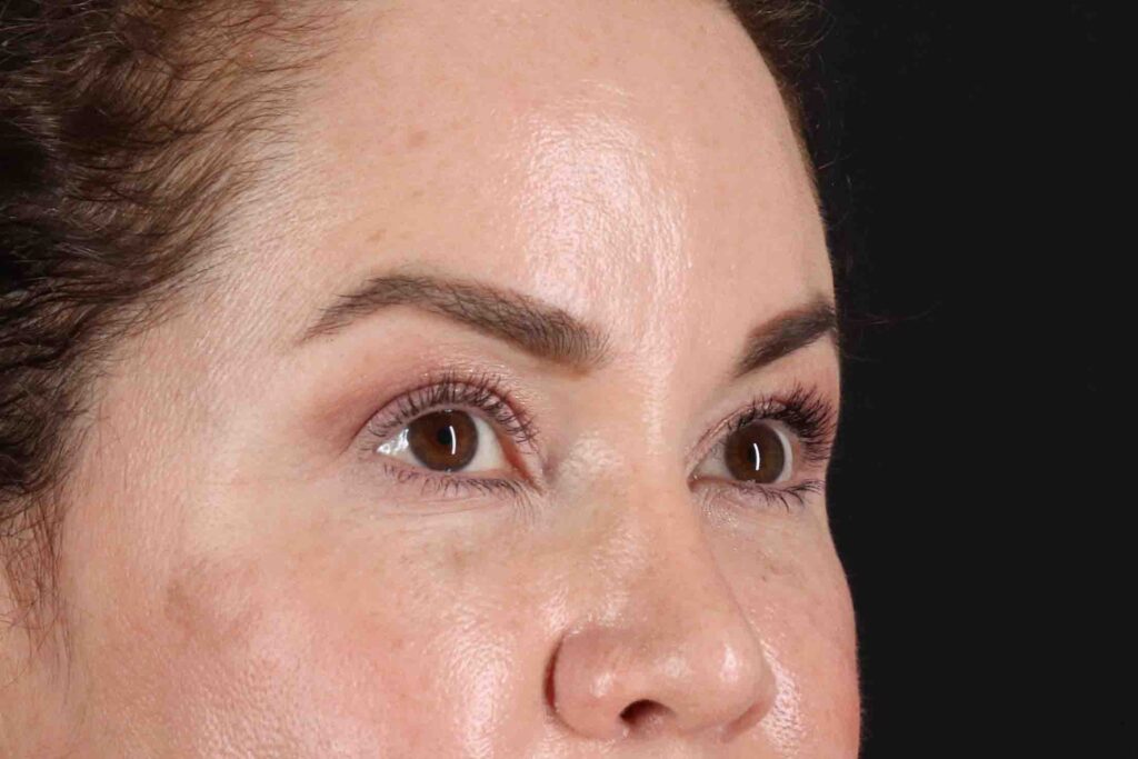 After - right_oblique