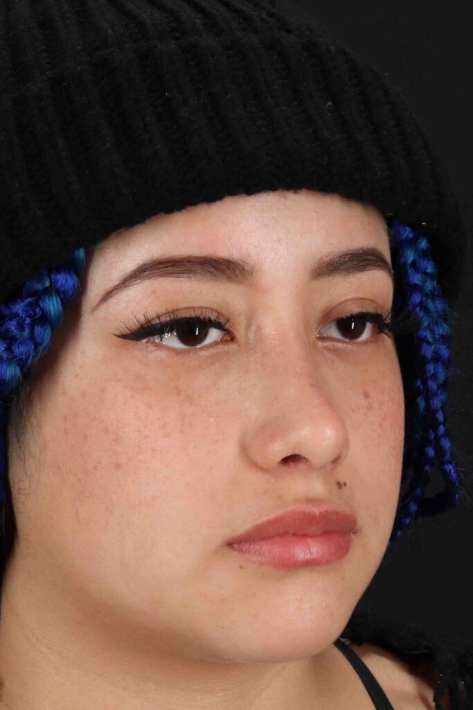 After - right_oblique