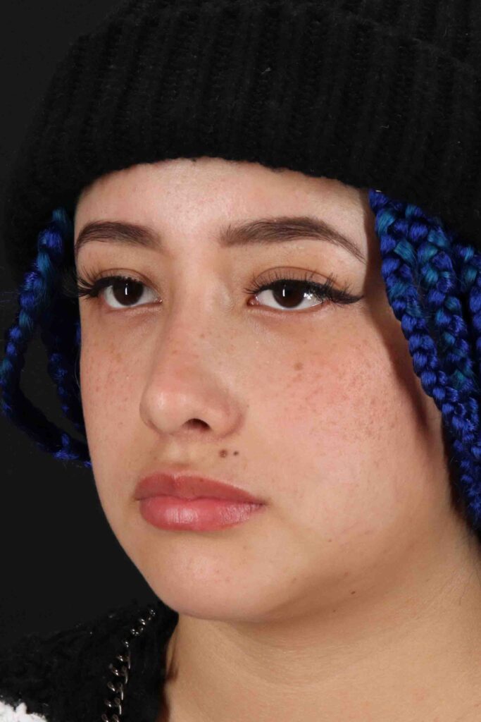 After - left_oblique