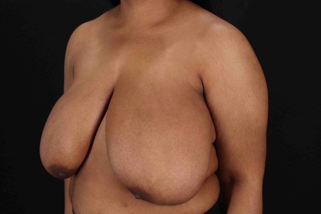 Before - left_oblique