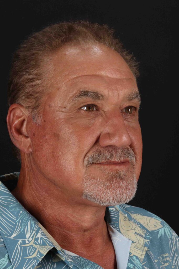 After - right_oblique