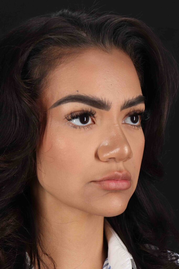 After - right_oblique