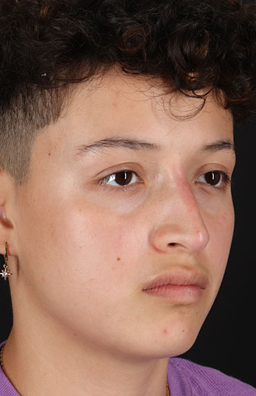 After - right_oblique