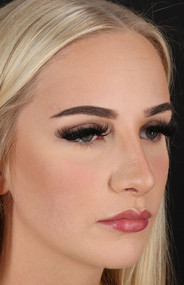 After - right_oblique