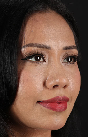 After - right_oblique