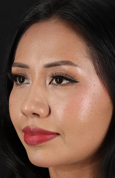 After - left_oblique