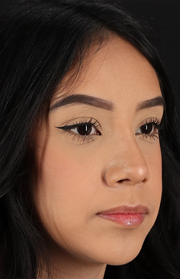 After - right_oblique