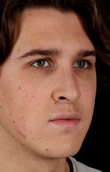 After - right_oblique