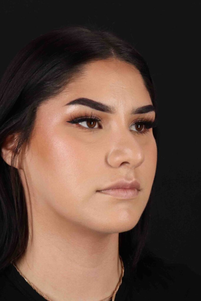 Before - right_oblique