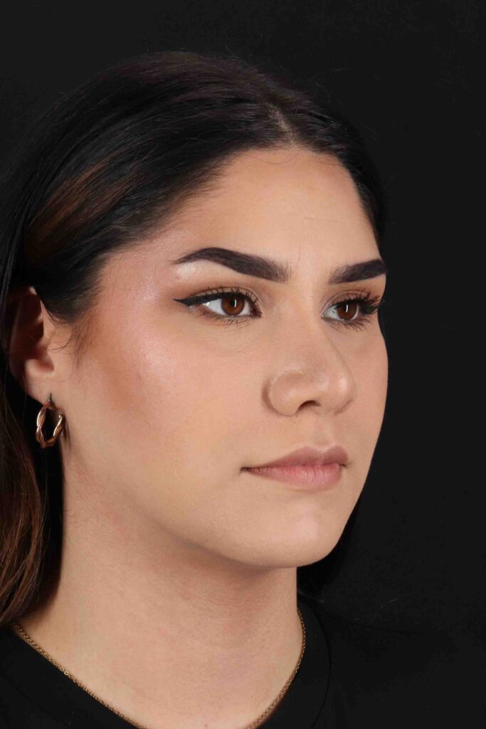 After - right_oblique