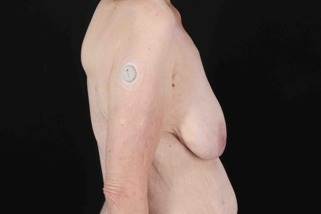 Before - right_lateral