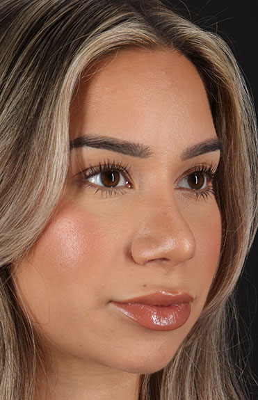 After - right_oblique