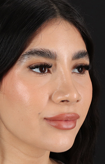 After - right_oblique