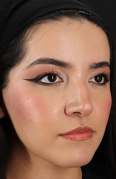 Before - right_oblique