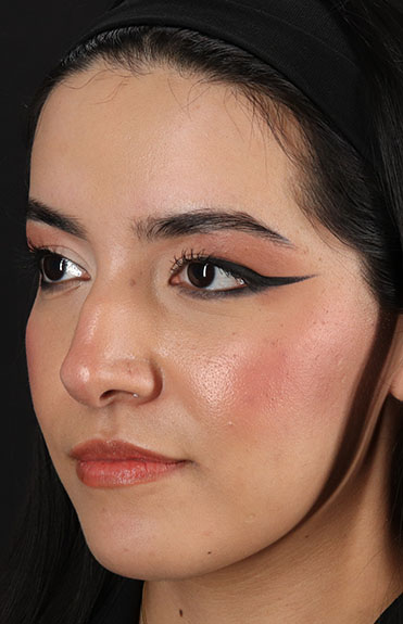 Before - left_oblique