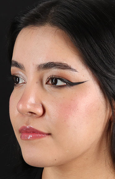 After - left_oblique