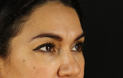 Before - right_oblique