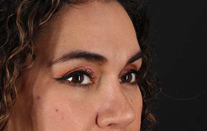 After - right_oblique