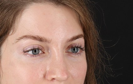 After - right_oblique