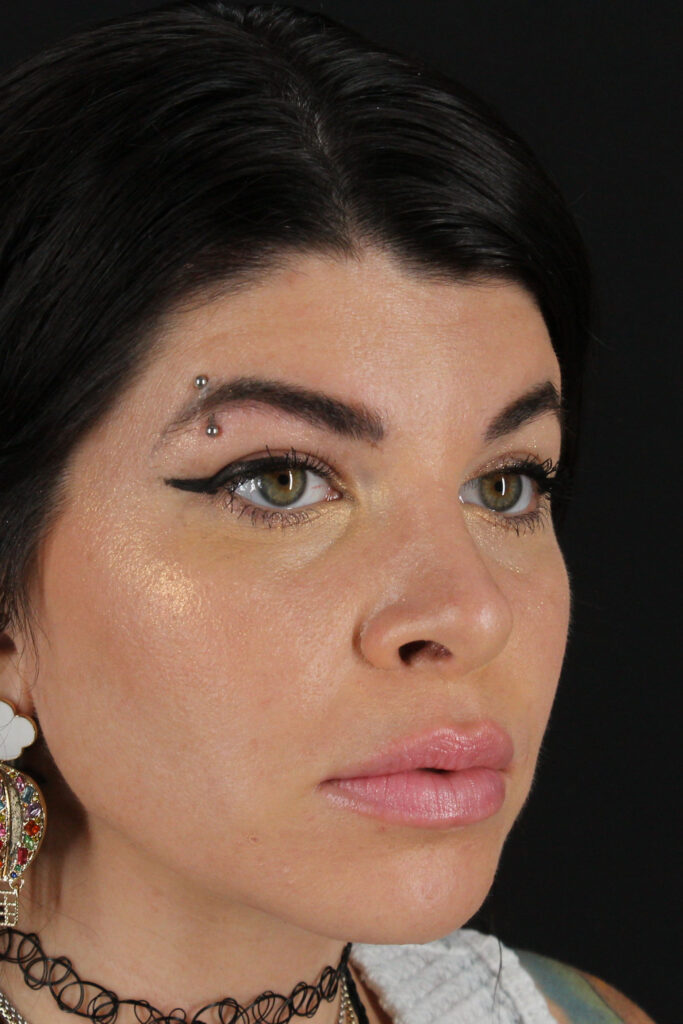 After - right_oblique