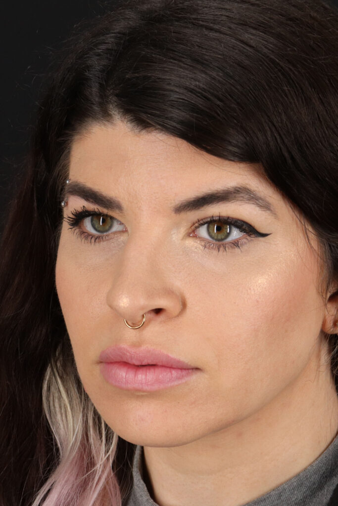 Before - left_oblique