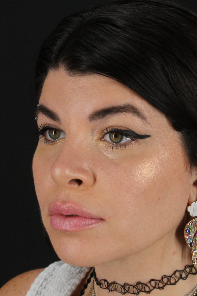 After - left_oblique