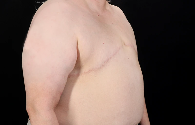 After - right_oblique