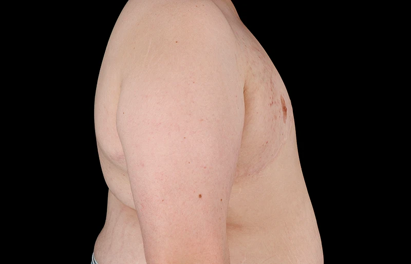 After - right_lateral