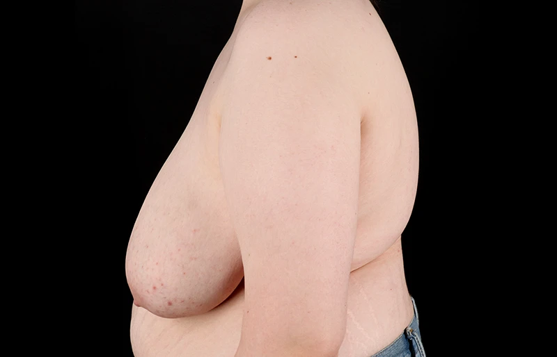 Before - left_lateral