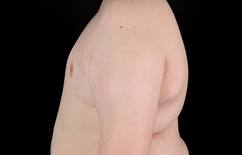 After - left_lateral