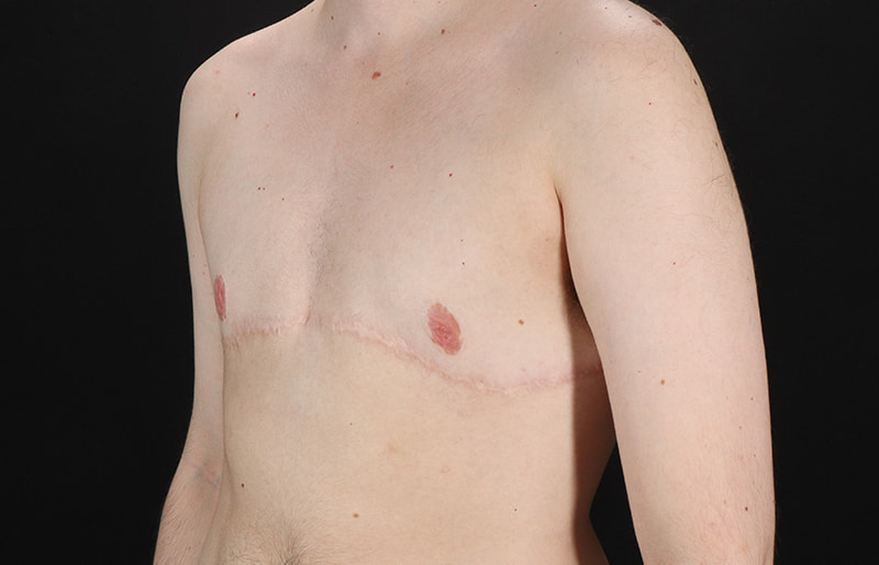 After - left_oblique