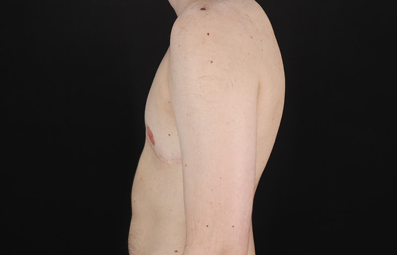 After - left_lateral