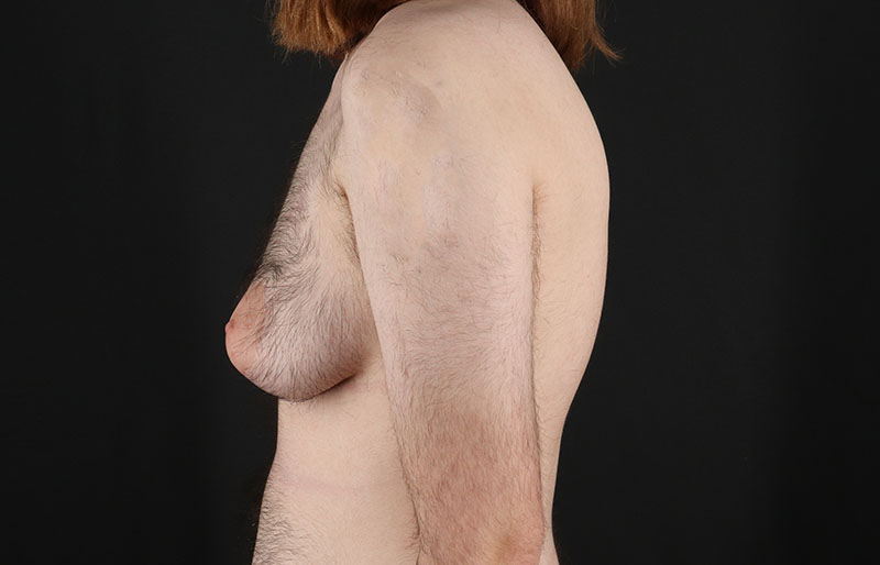 Before - left_lateral