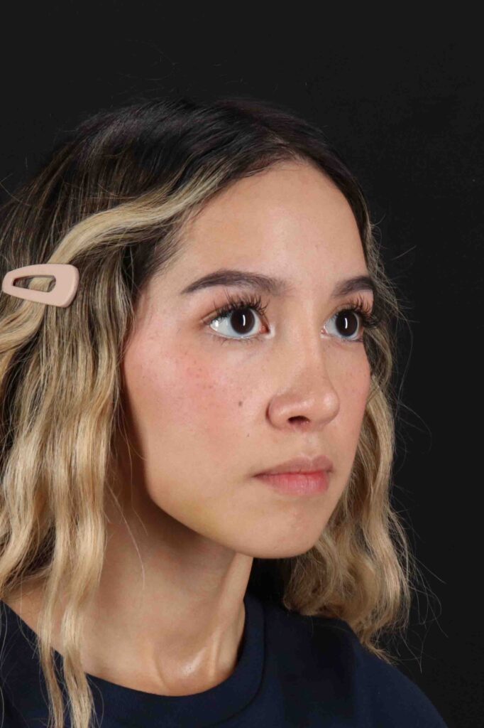 After - right_oblique