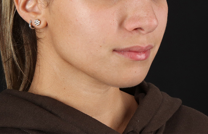 After - right_oblique