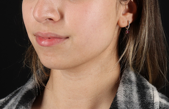 Before - left_oblique