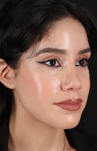 After - right_oblique