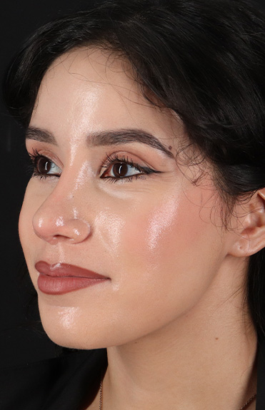 After - left_oblique