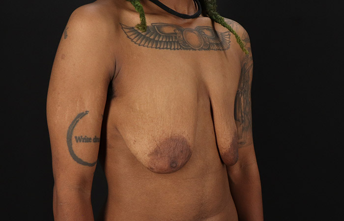 Before - right_oblique