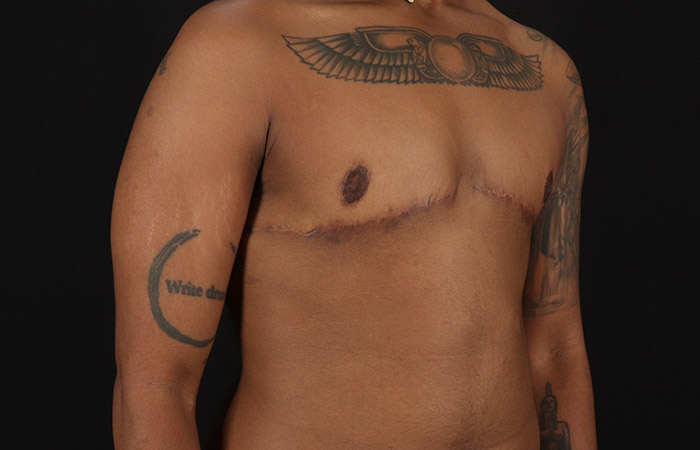 After - right_oblique